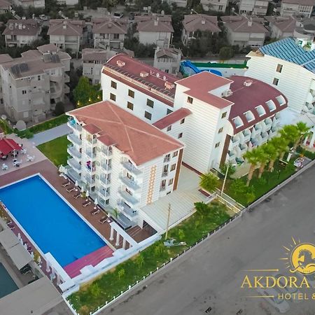 Akdora Resort&Spa Side Luaran gambar